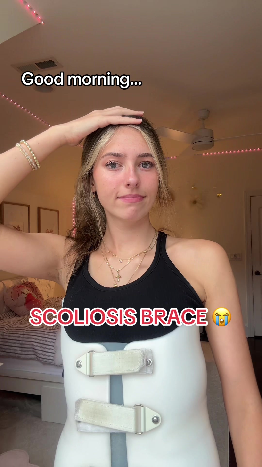 @Em bracethescoliosis