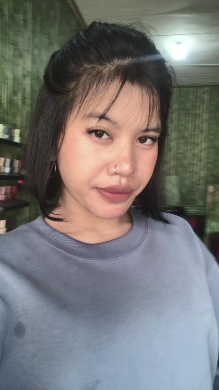 @101