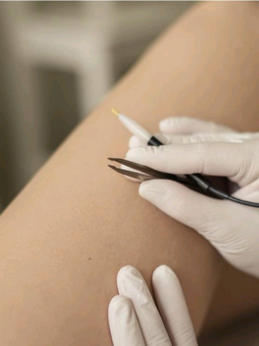 @Nadine Electrolysis.Waxing
