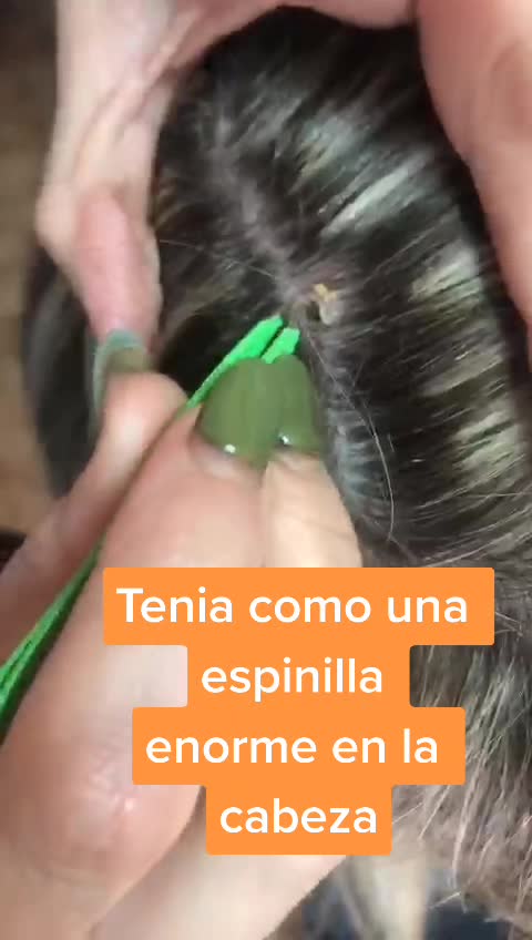 @Josefina Garcia Angu