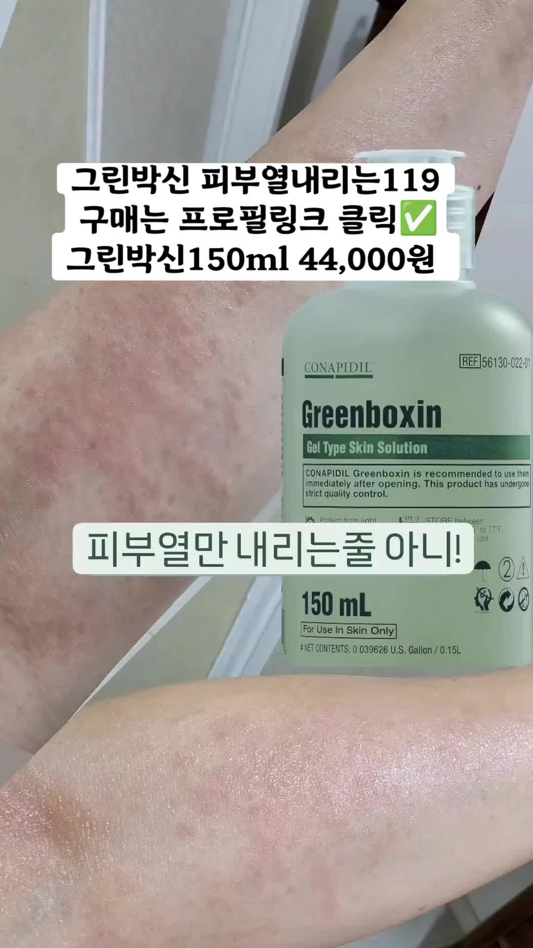 @더스파다운(여드름피부전문스파)