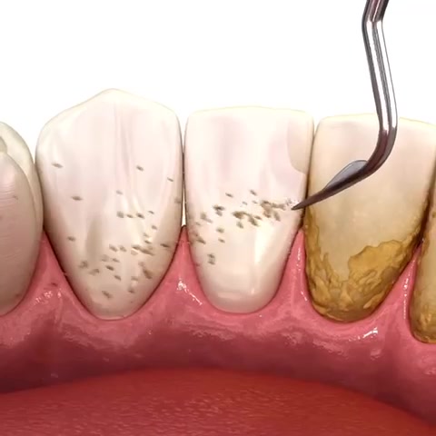 @Perfect White Smile/ Dr. Frey