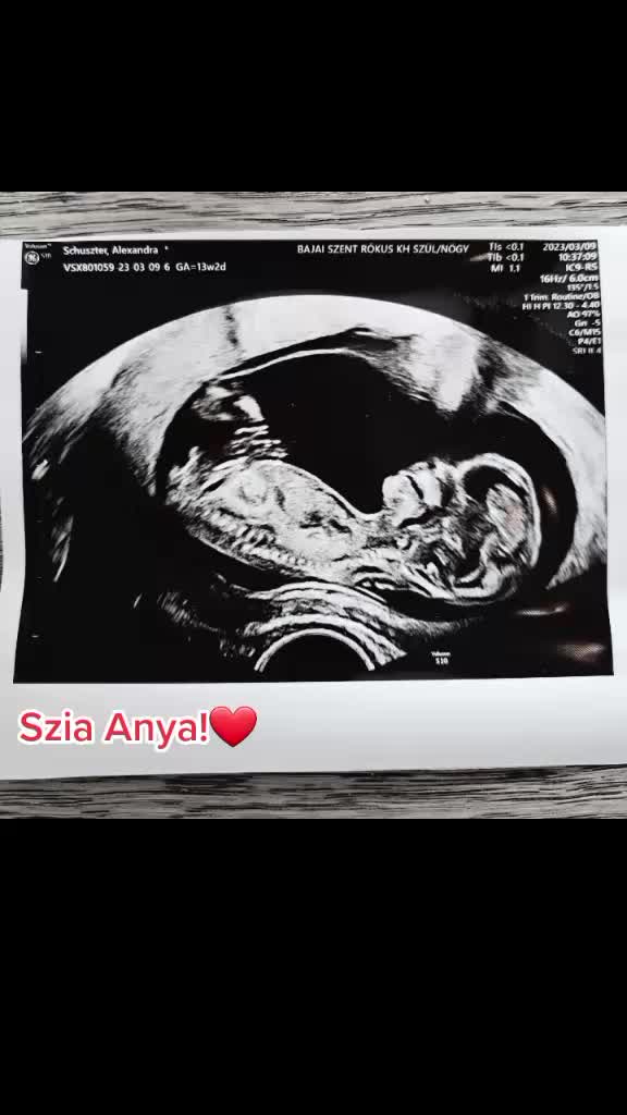@_schuszter_alexandra_