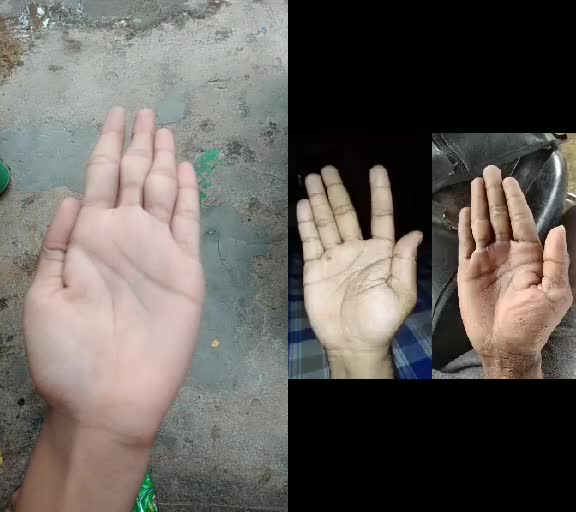@CHINNU