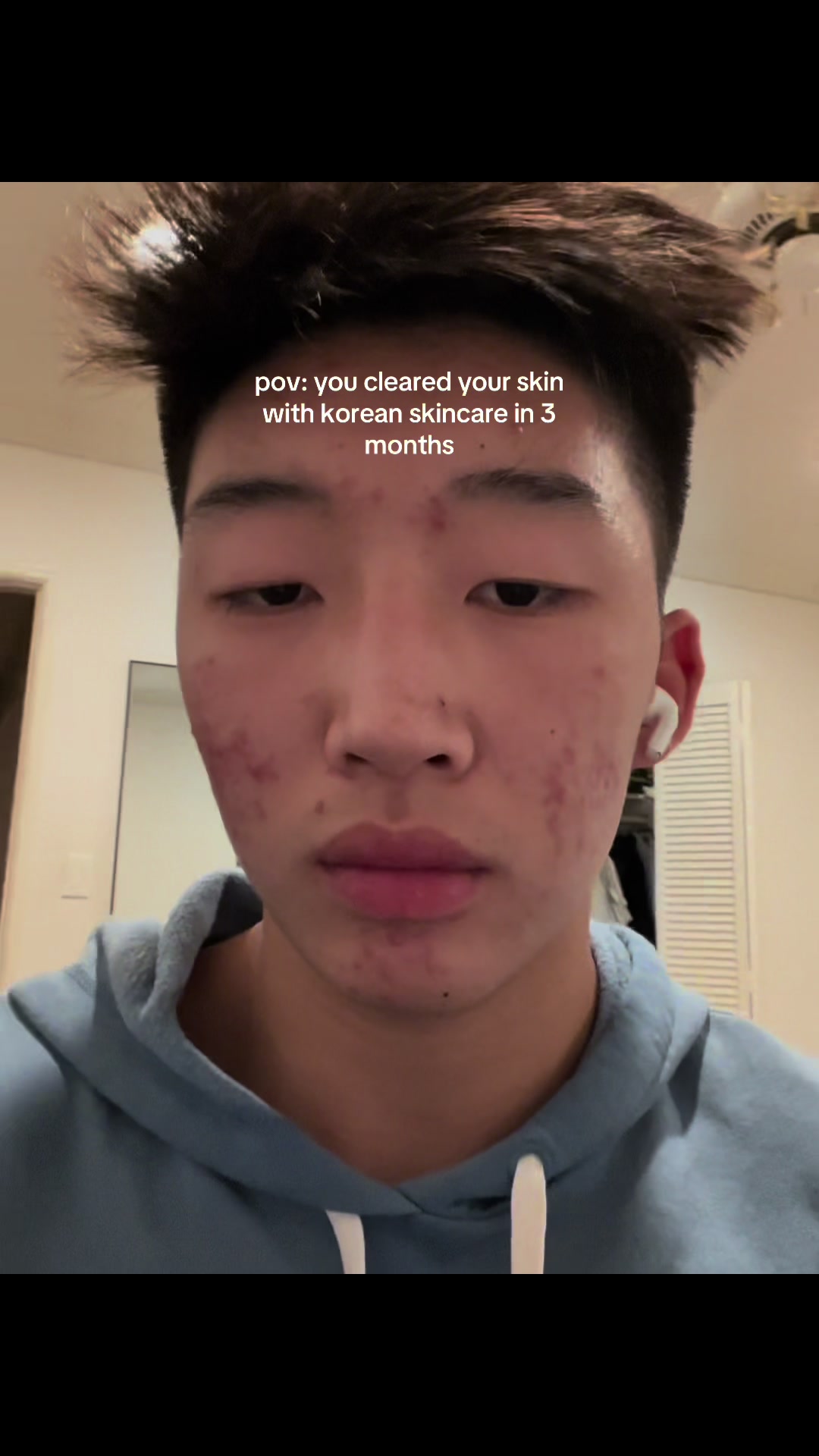 @JUSTIN