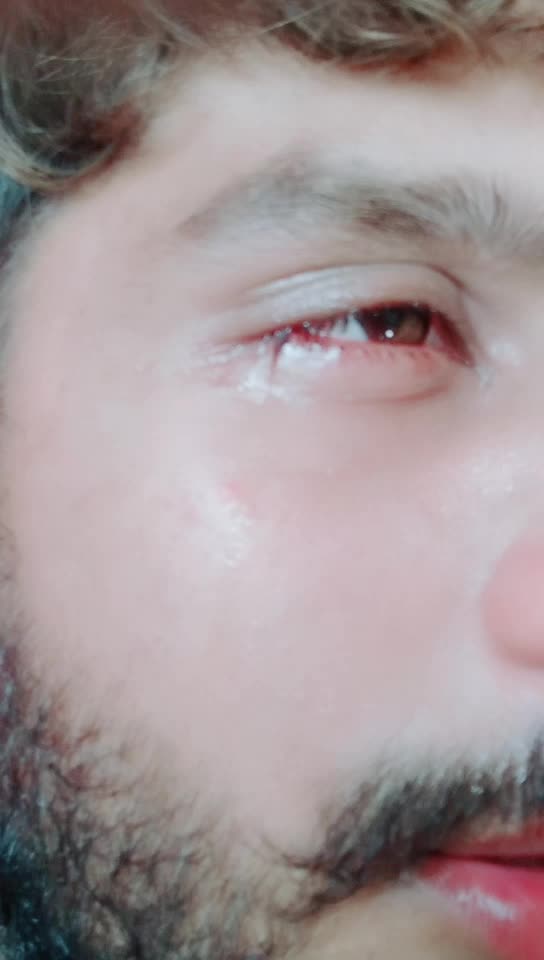 @boxerboora.0001