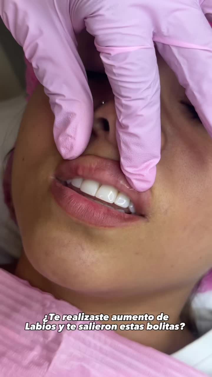 @Perfilamiento Facial Cali