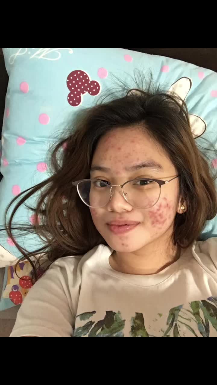 @ag
