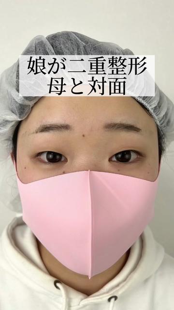 @【二重整形】TCB 新宿東口院ゆいこ先生/東京