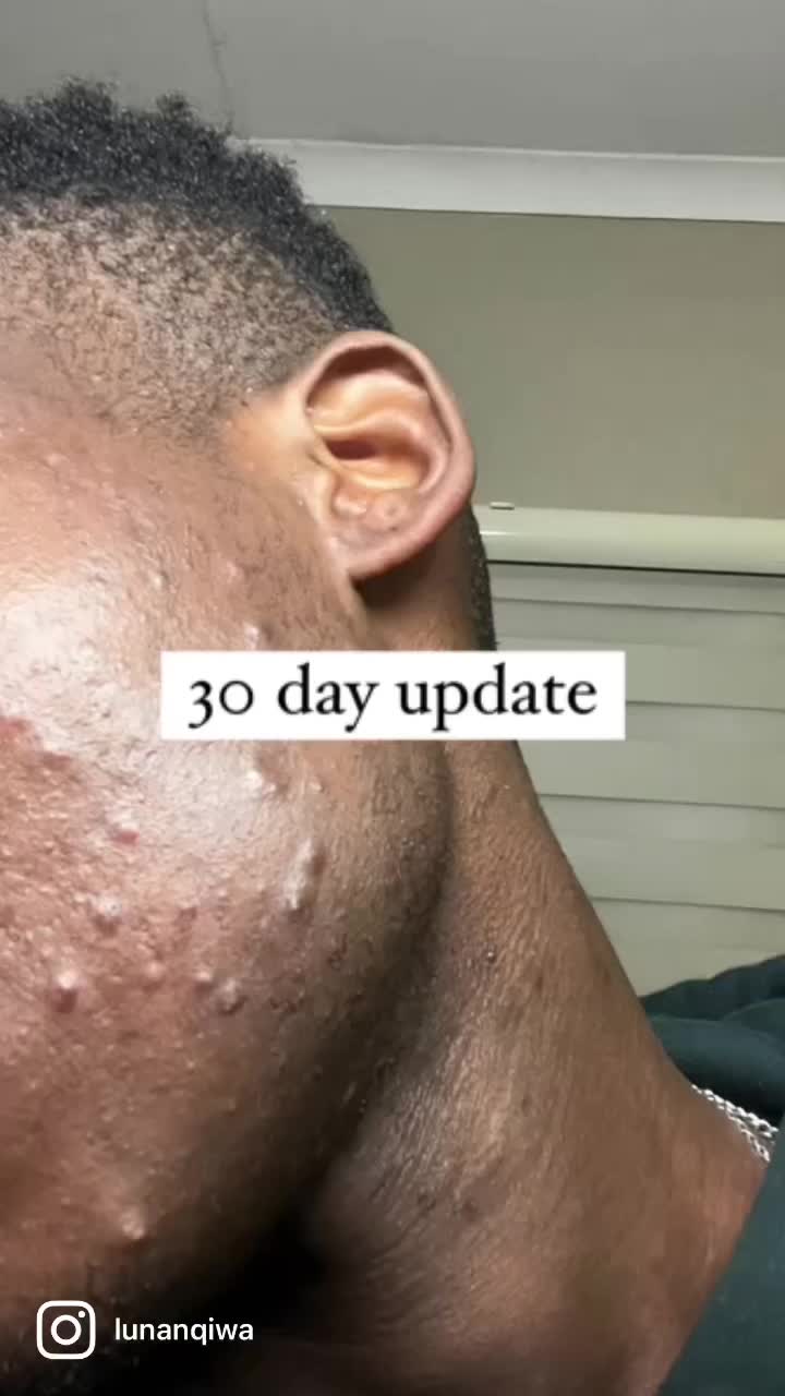 @Luna Nqiwa | SKINCARE | HAIR