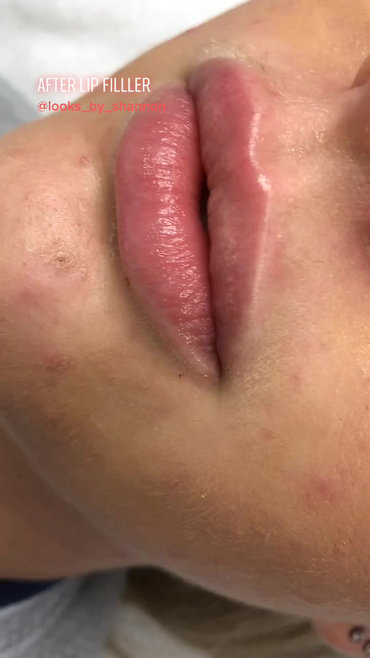 @shannonarnp