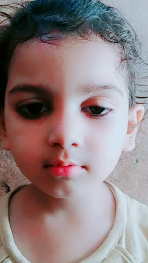 @Tejpal Pal