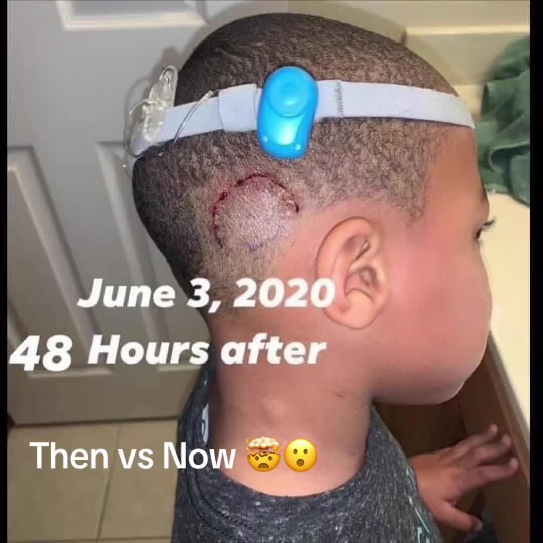 @TS Hairgrowth Products