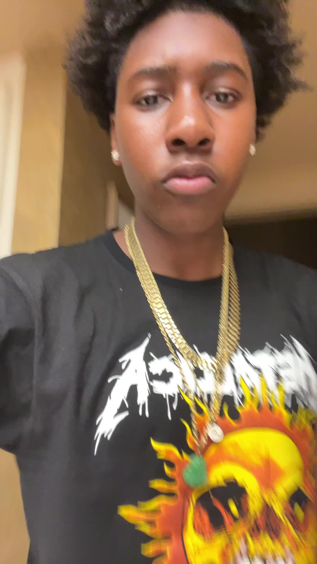 @User576887