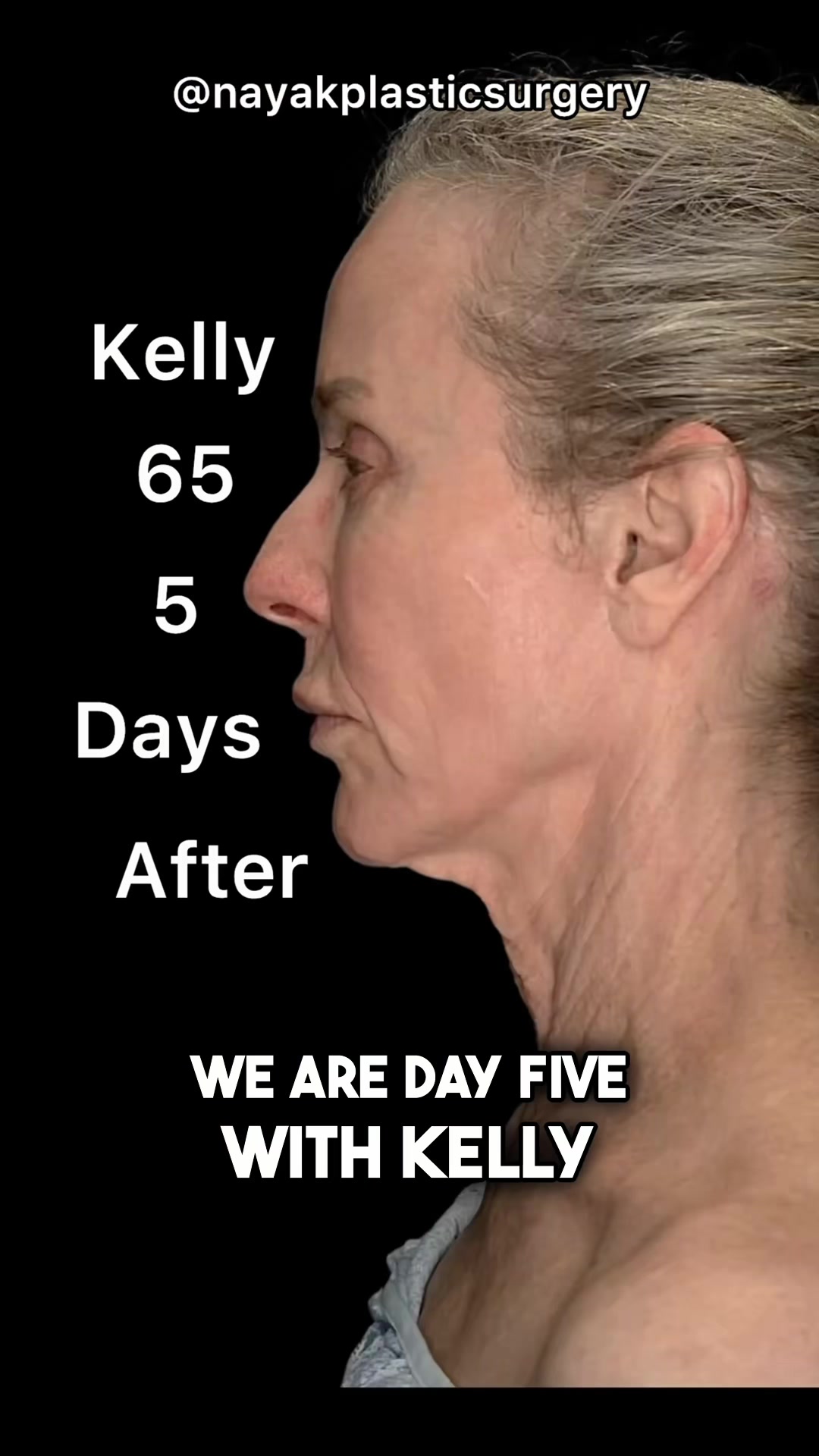 @NayakPlasticSurgery
