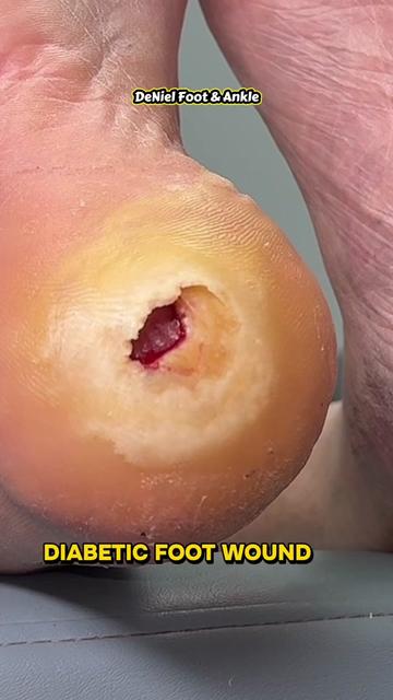 @Deniel Foot and Ankle Center