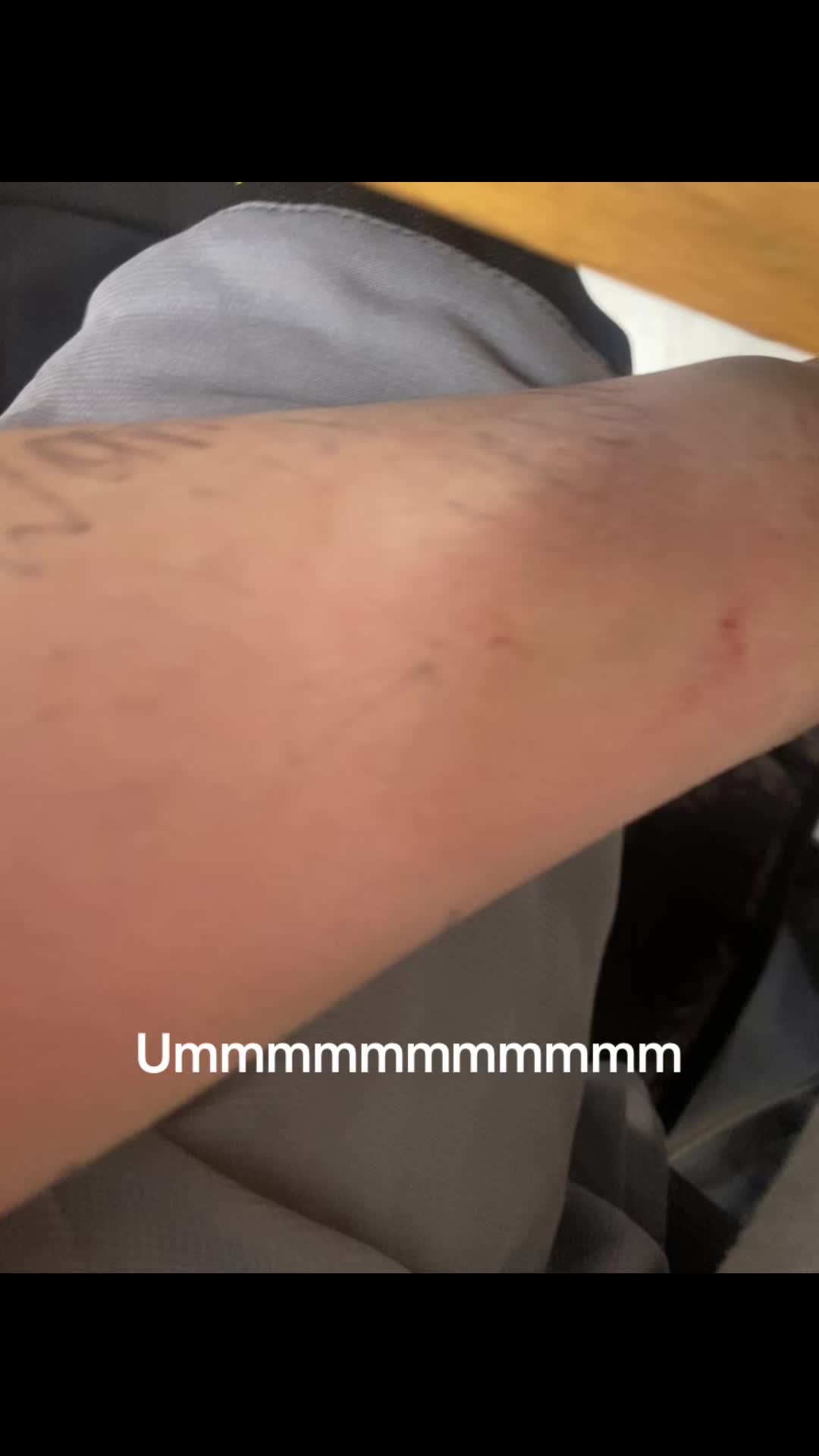 @Umm