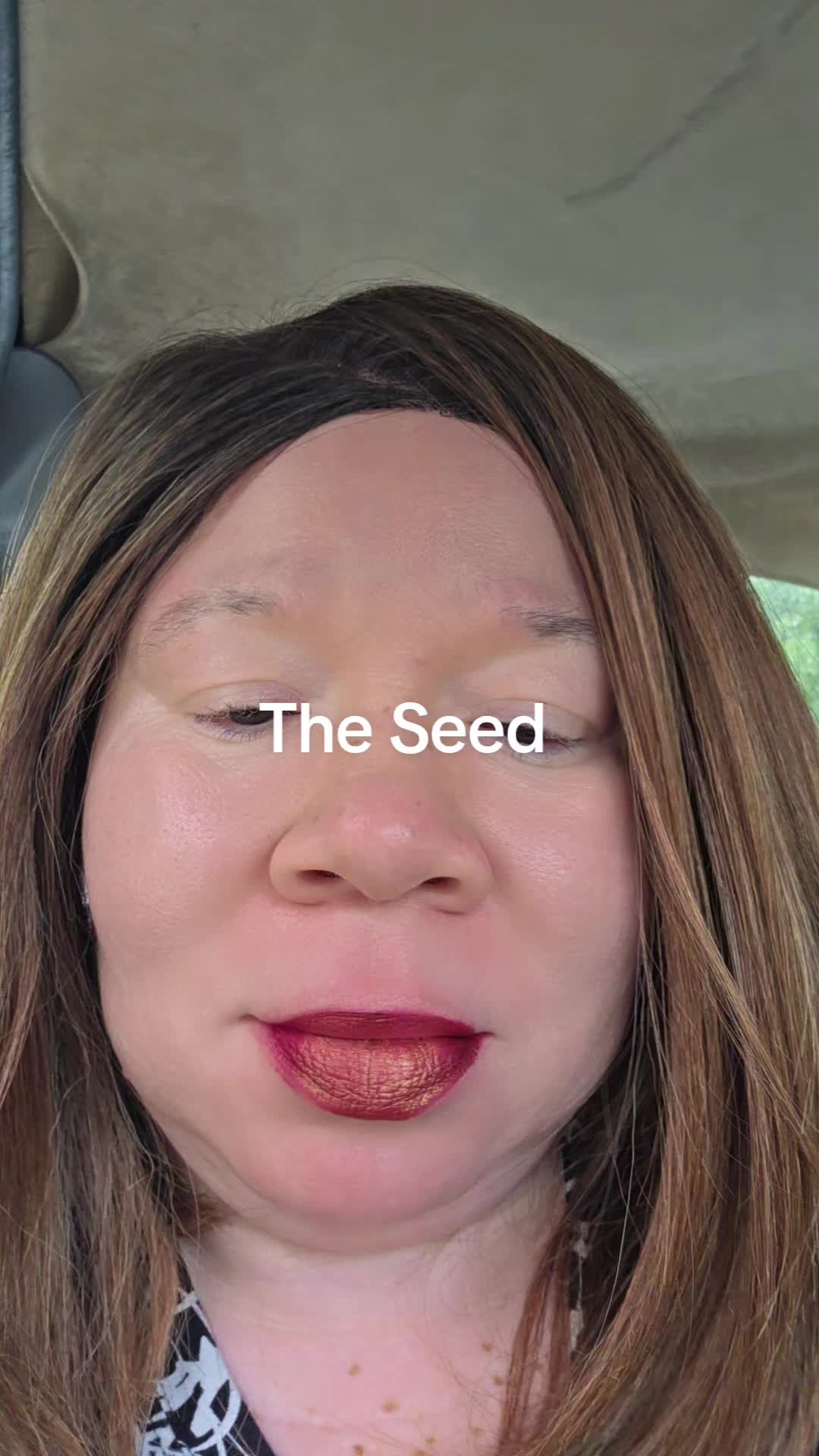 @Miss. PinkY(vitiligo girl)