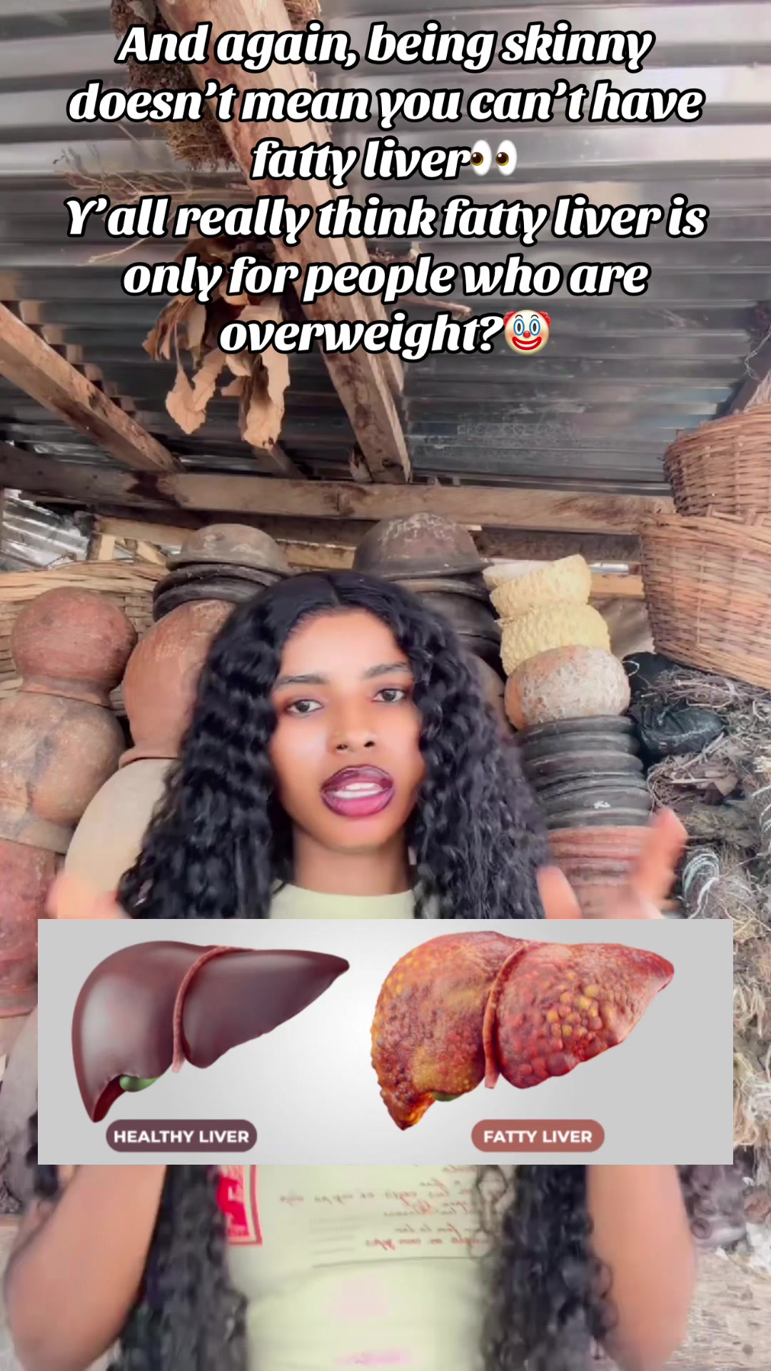 @GeNz_alagbo🐍🍯