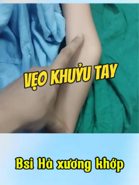 @Chuyên gia xương khớp