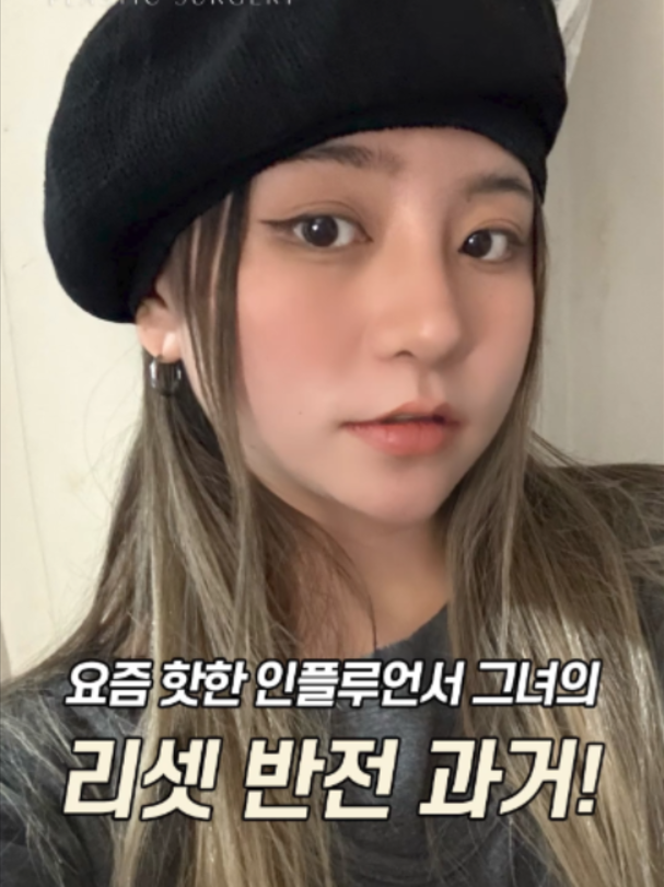 @리셋성형외과