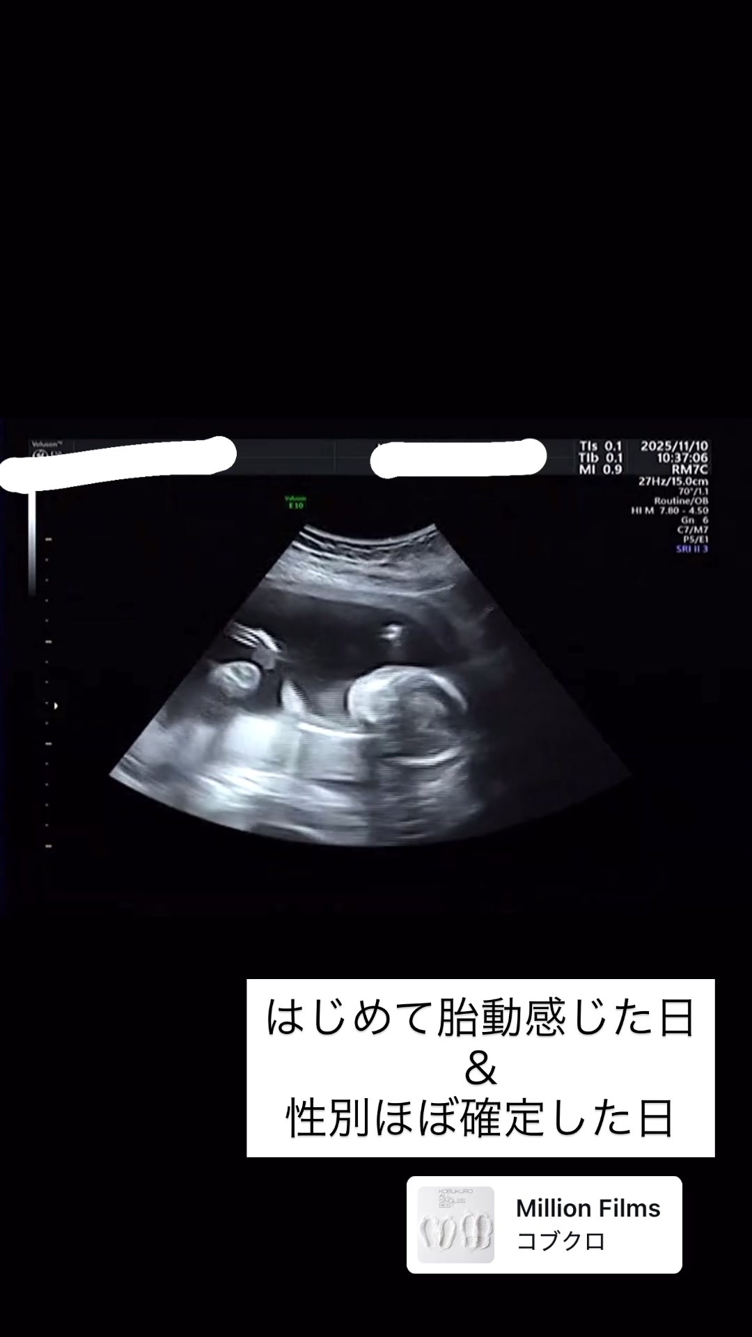 @Baby/WAð¶ð»ðŒ