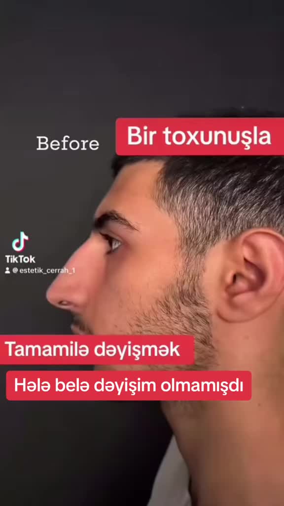 @Estetik_cerrah