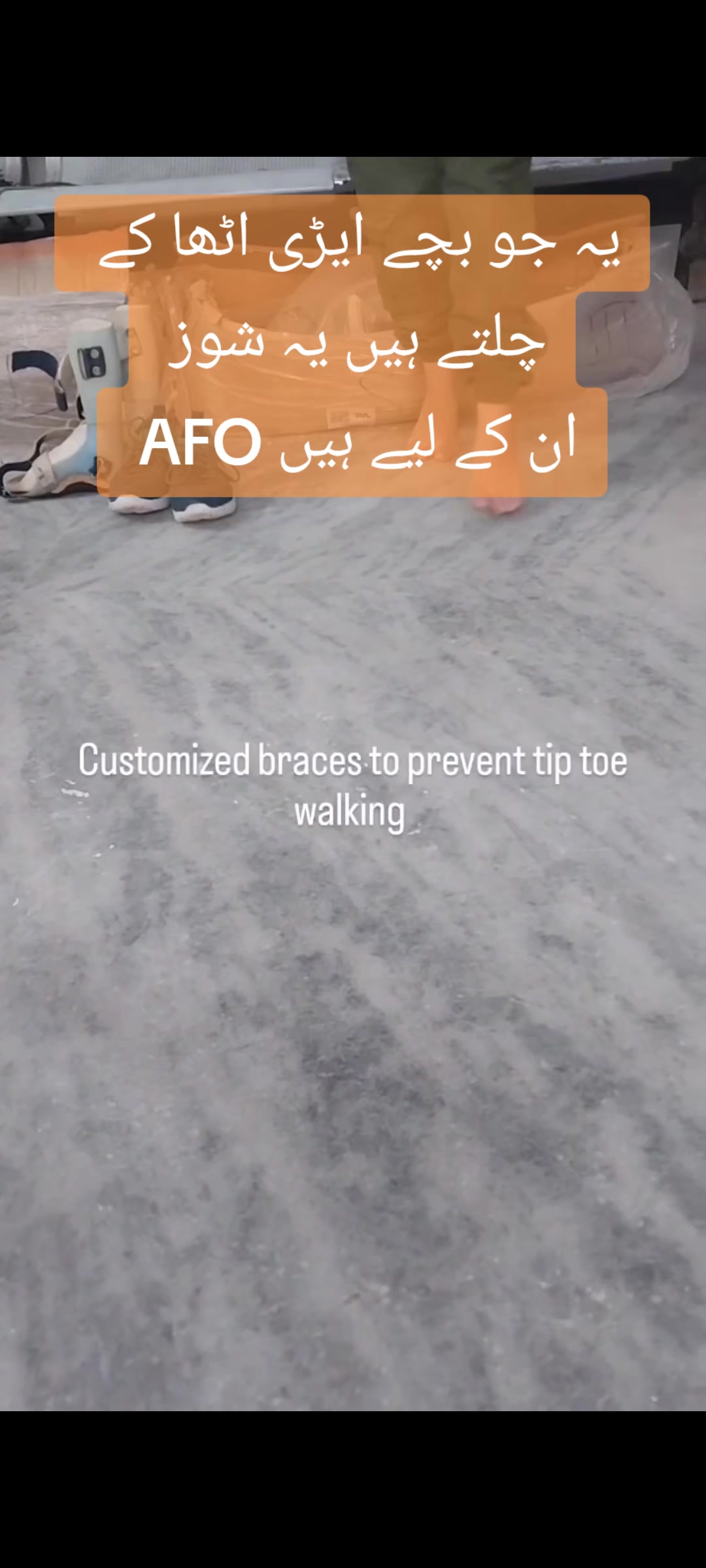 @مصنوعی اعضاء