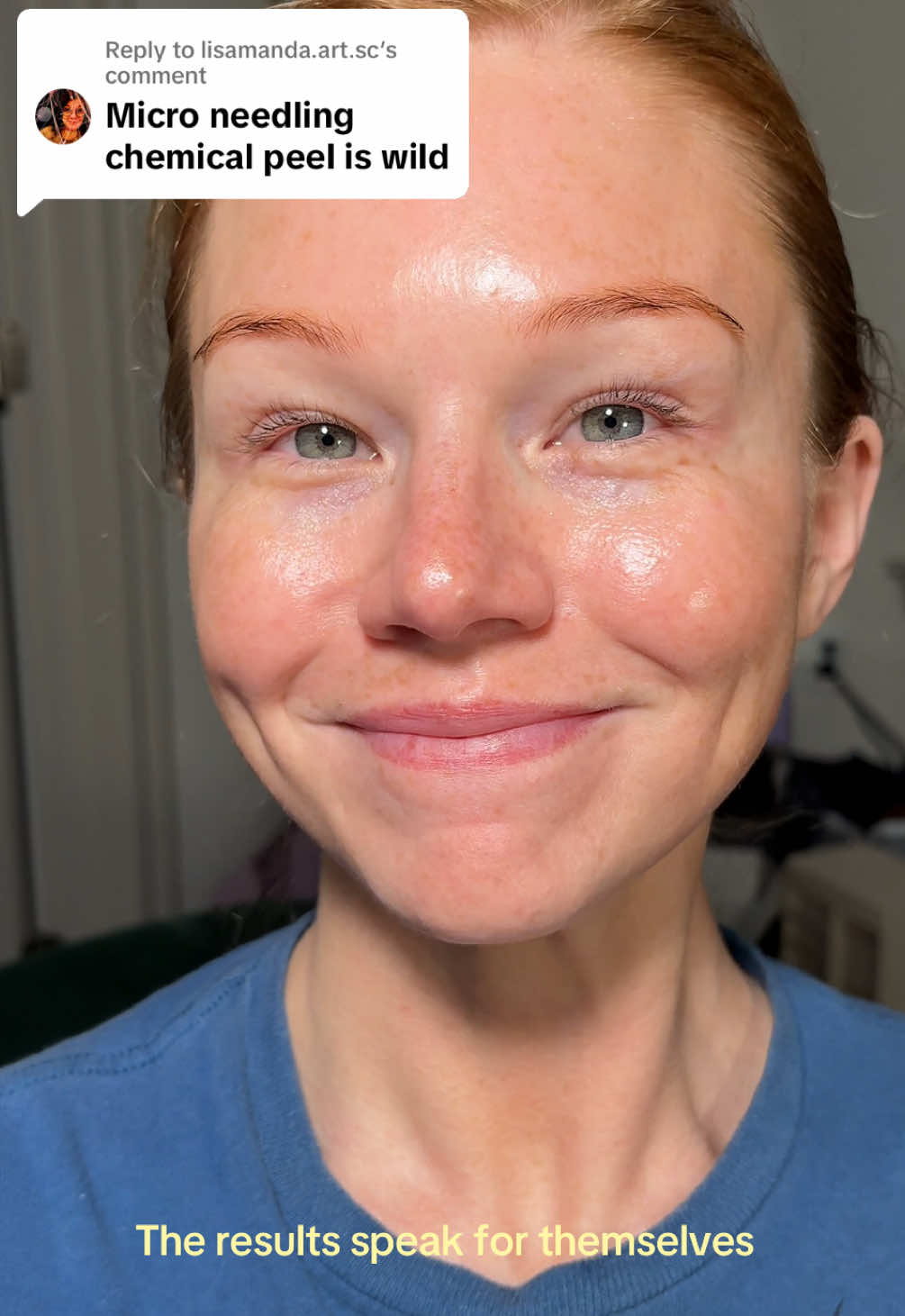 @Krystn Walmsley