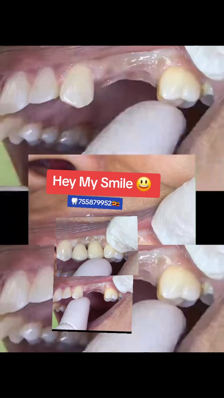 @Allianz Dental studio🦷🦷🇺🇬