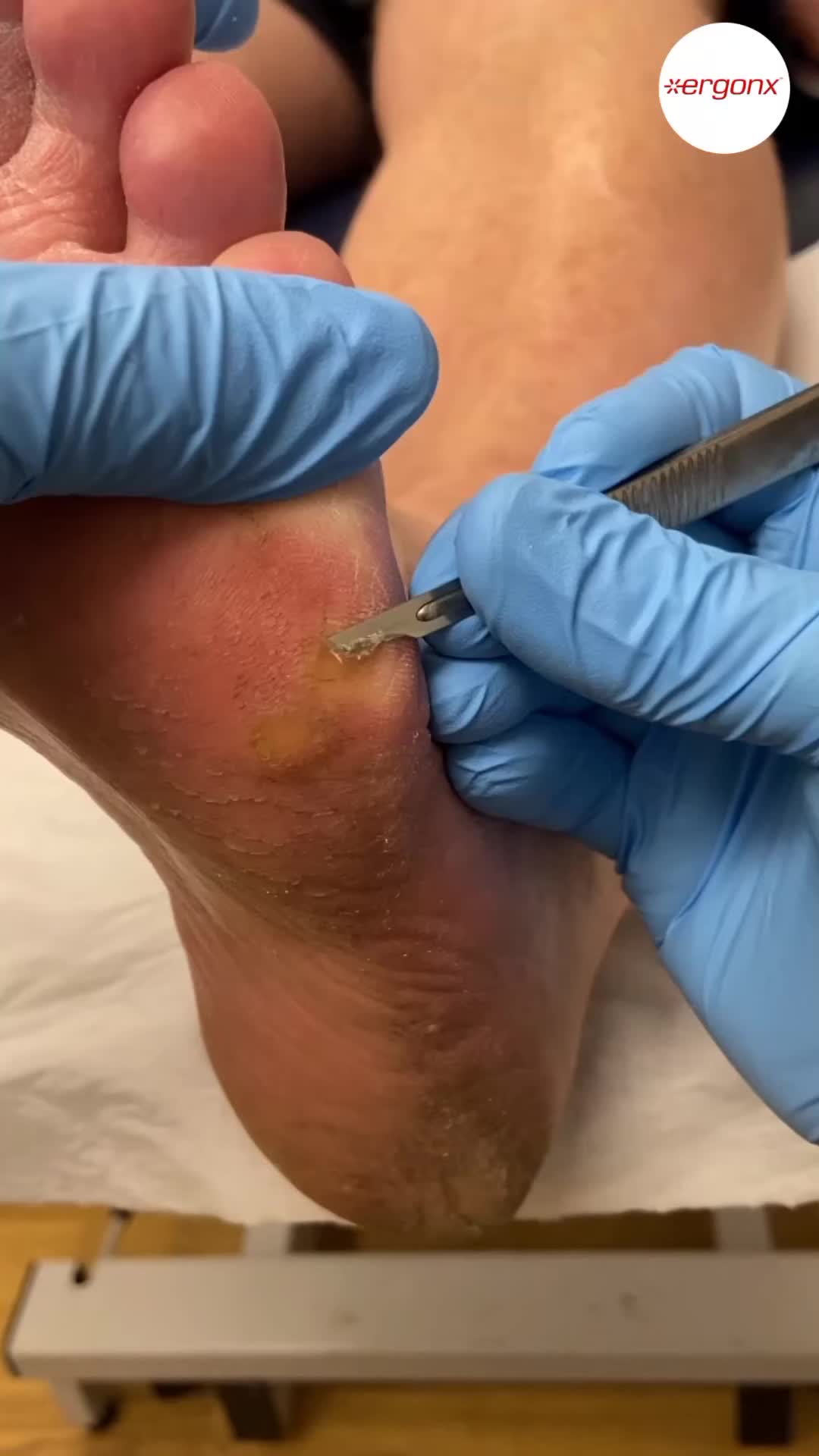 @ergonx