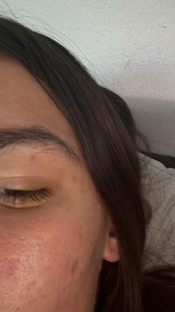 @Juju