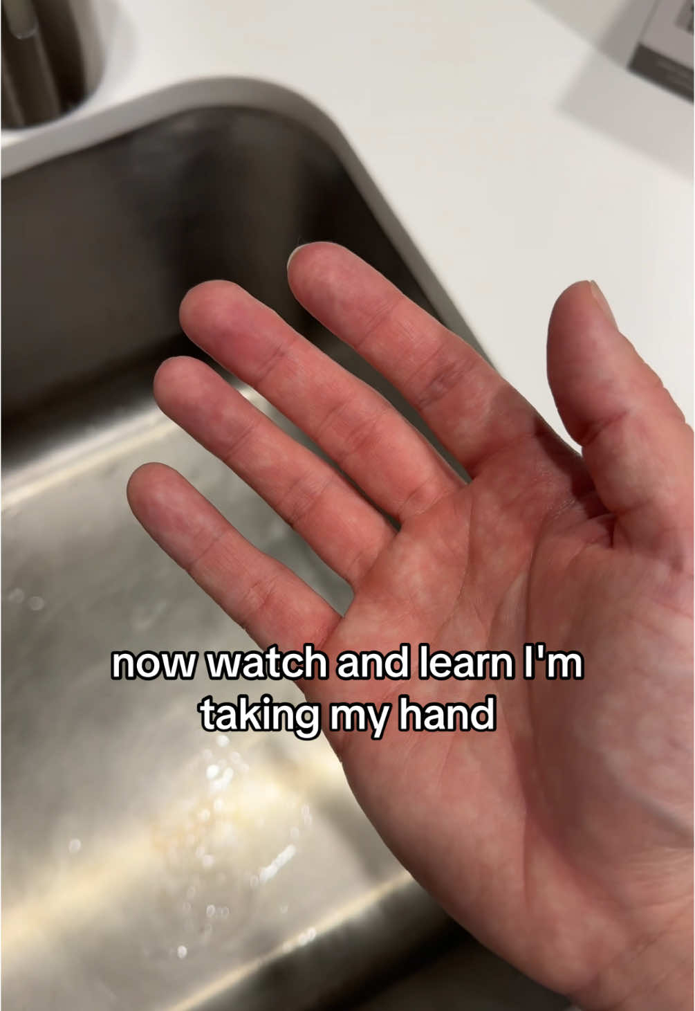 @MANIFEST