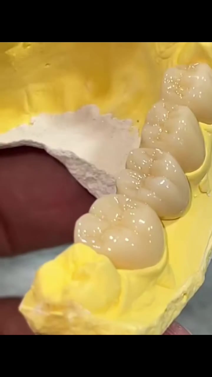 @Dr_sheraz_official 🦷