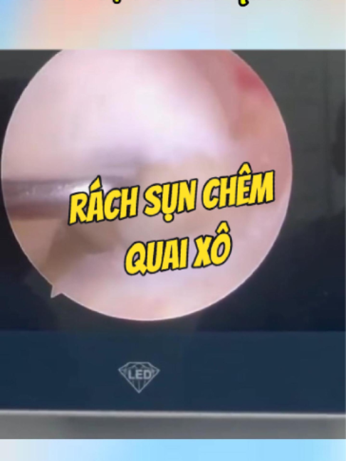 @Chuyên gia xương khớp
