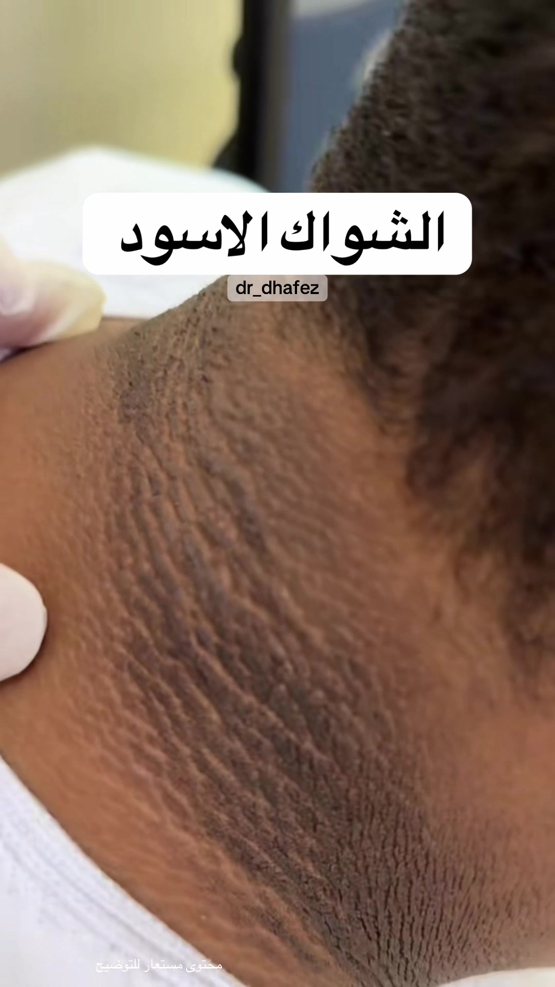 @د. ظافر آل حافظ