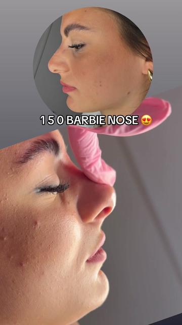 @Rosa.medical.cosmetic💉💕