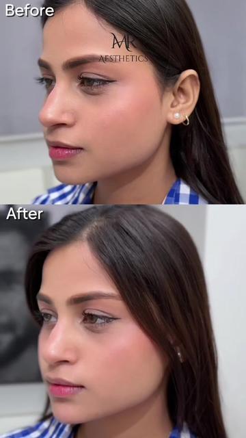 @MR Aesthetics 📞 0325 9611110