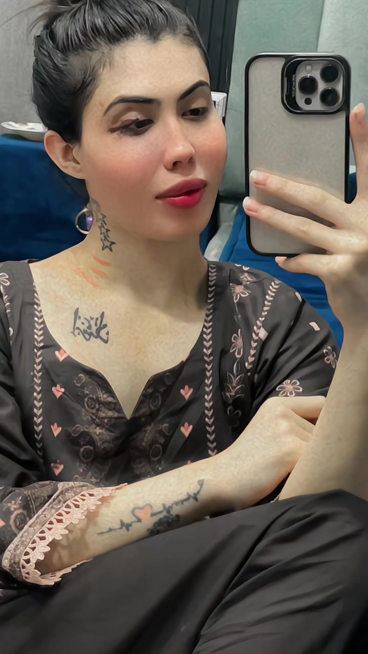 @APPLE 44 🍎🍎