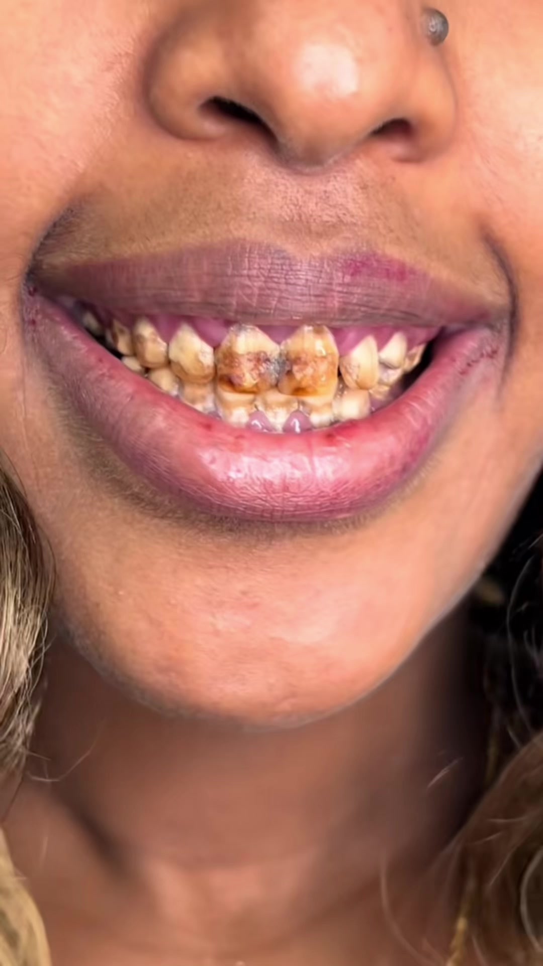 @drhelina_smile_architect