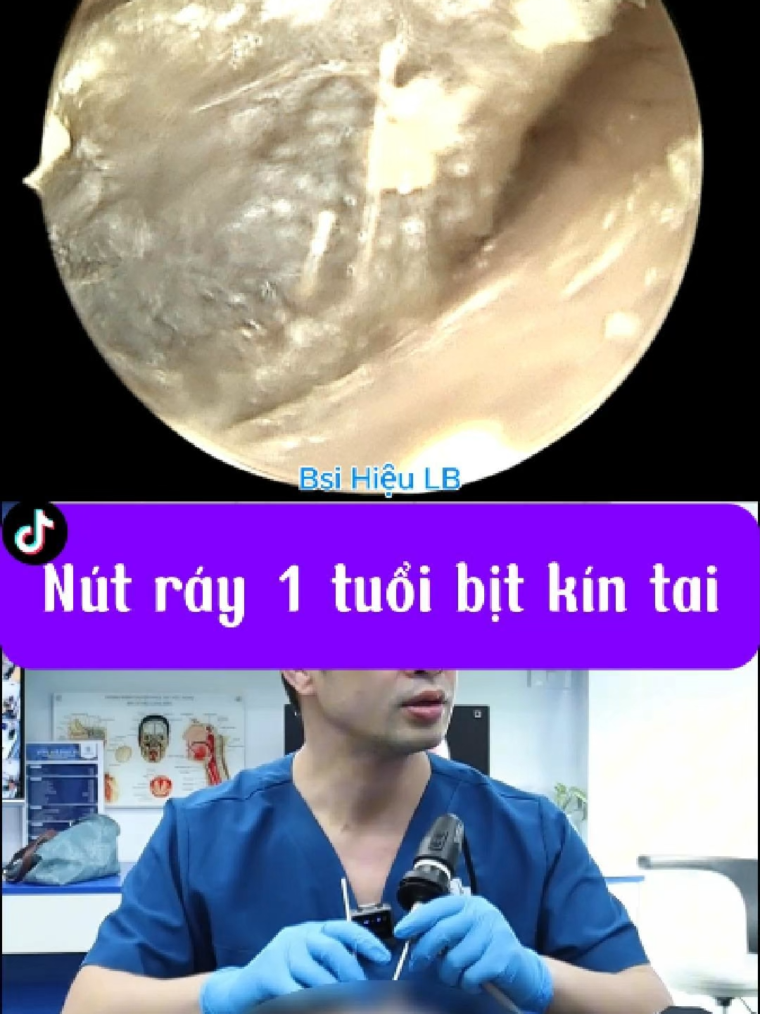 @Bs Hiệu Tai Mũi Họng Long Biên