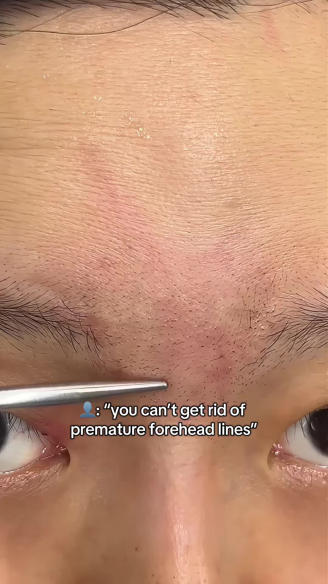 @Tracyskin