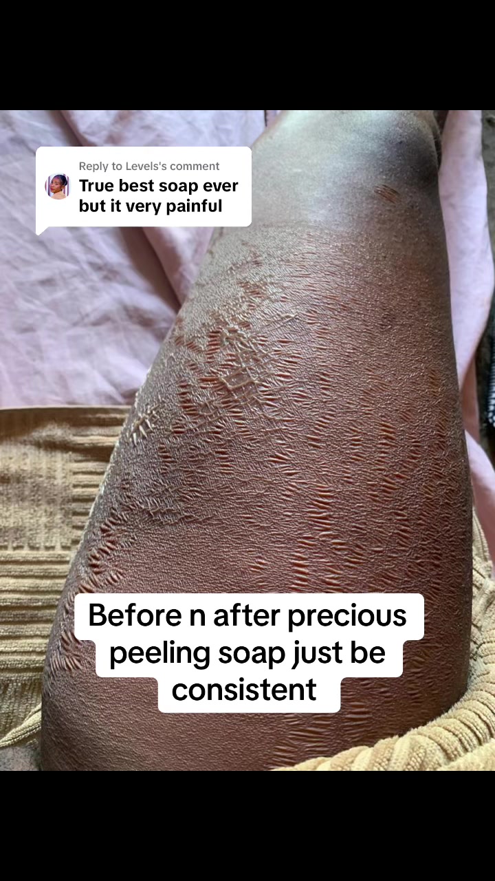 @@ Precious peeling soap