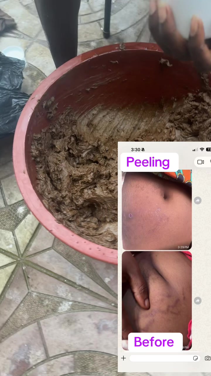 @@ Precious peeling soap