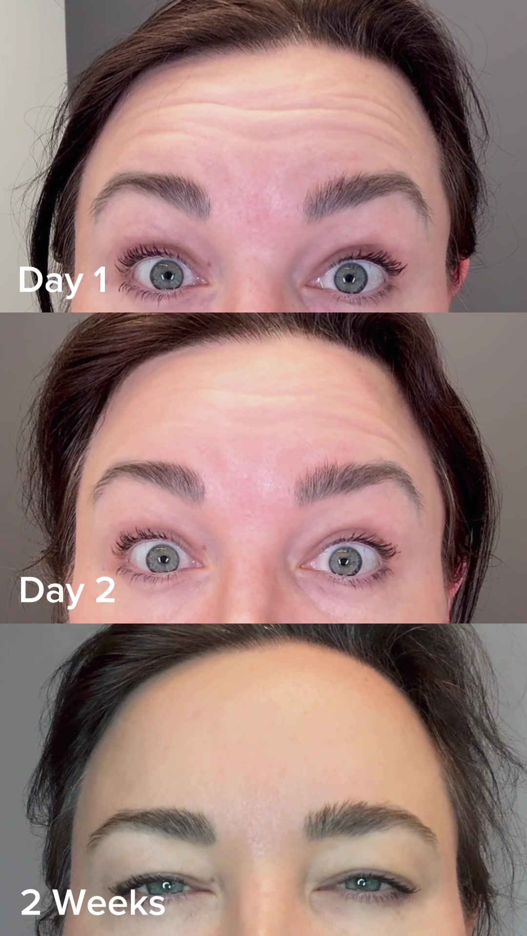 @Rosedermnyc