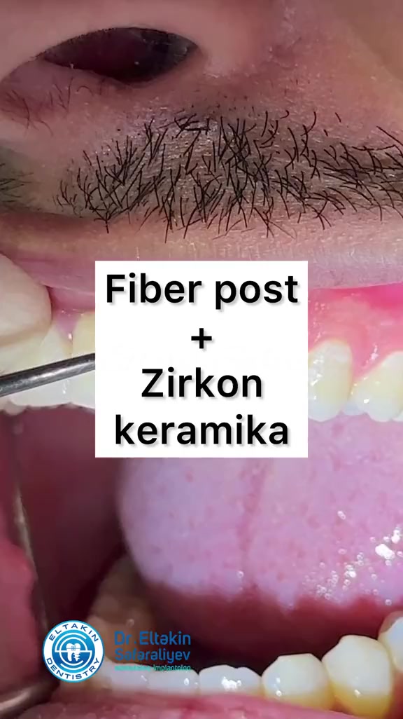 @eltakindentistry