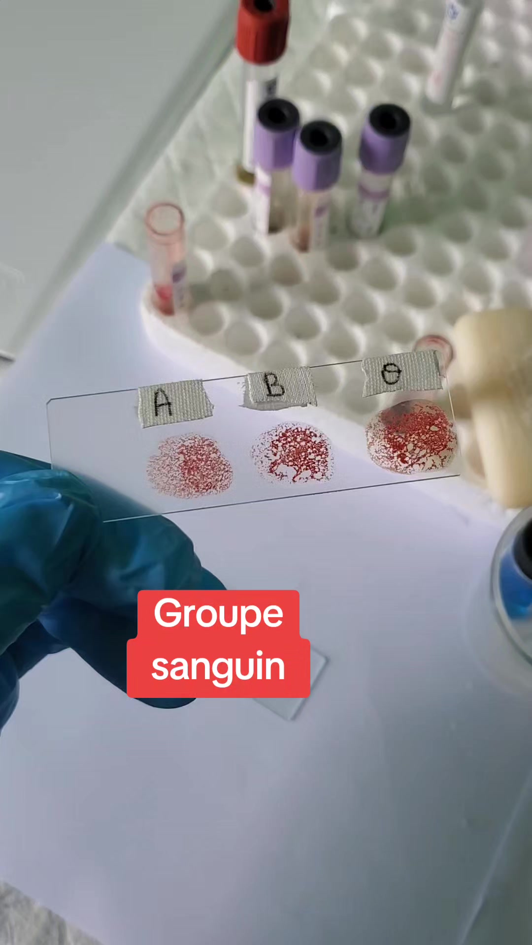 @Biologiste-Mompepe🔬💉😊