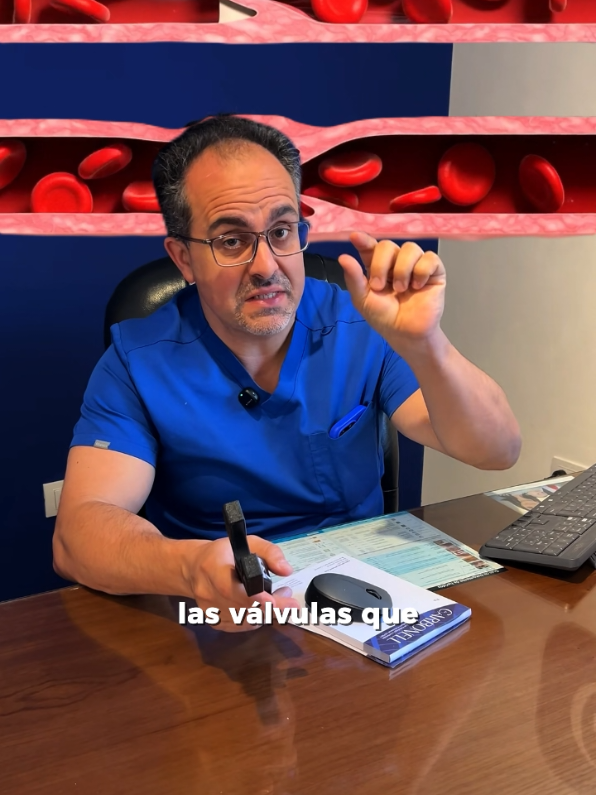 @Varices Carbonell