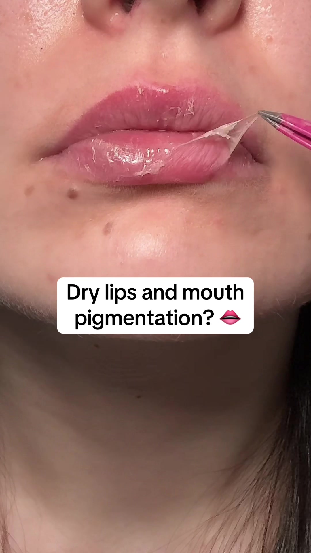 @watermelonsugarskin