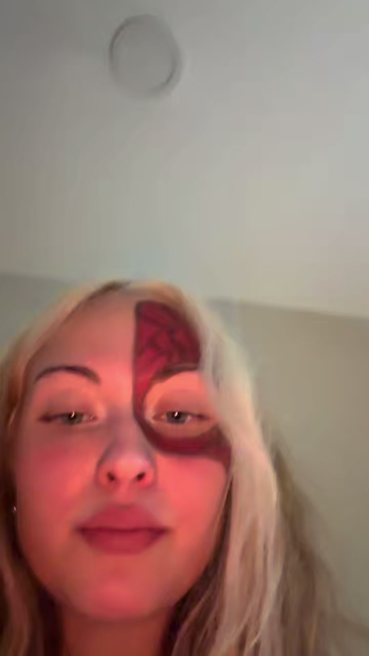 @errmiLKA